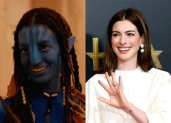 Nhan sắc gây sốc của Anne Hathaway, dụi mắt 1000 lần vẫn nhận không ra