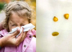 Cảnh báo tình trạng trẻ nhỏ nhét dị vật vào mũi