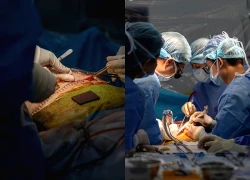 Nam sinh viên hiến gan cứu giảng viên thoát cửa tử vì suy gan cấp