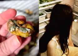 Trung Quốc: Cô gái 27 tuổi bị ung thư dạ dày vì 3 món hay trữ trong tủ lạnh