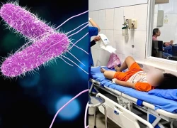Vụ ngộ độc khi ăn bánh mì ở Phan Thiết: Nem chua và thịt xá xíu nhiễm khuẩn Salmonella