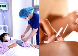 Y học cổ truyền trong dự phòng và điều trị đột quỵ