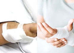 Liên tiếp nhiều người cấp cứu vì vết xước nhỏ xíu