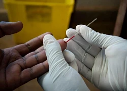 UNAIDS lo ngại việc Mỹ ngừng viện trợ nước ngoài