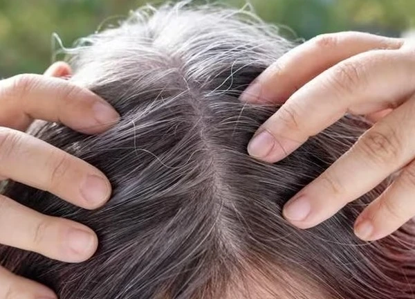 6 thói quen khiến tóc bạc sớm