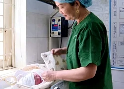 Cứu sống mẹ con sản phụ bị sa dây rốn hiếm gặp