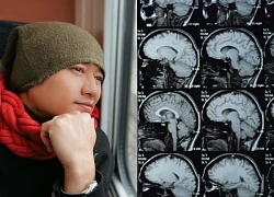Căn bệnh u não khiến Quý Bình qua đời, nguy hiểm ra sao?