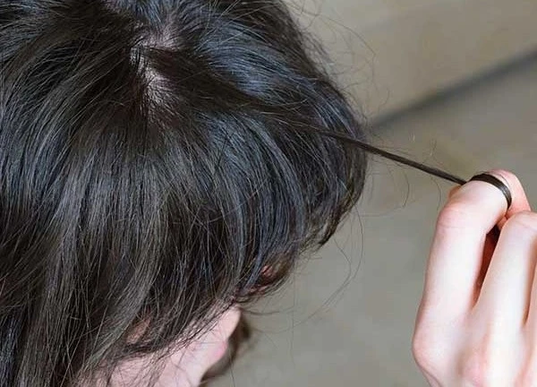 Hội chứng nghiện giật tóc: Nguyên nhân, biểu hiện, cách điều trị và phòng bệnh