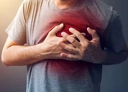 Phát hiện cách cholesterol gây đau tim