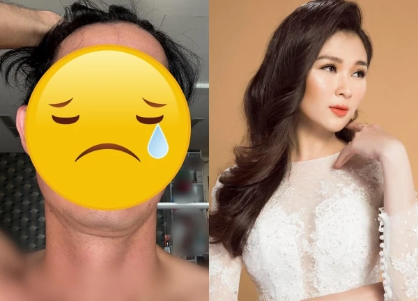 Huy Khánh mắc "bệnh lạ", mặt biến dạng sốc hậu ly dị, vợ cũ ngó lơ?