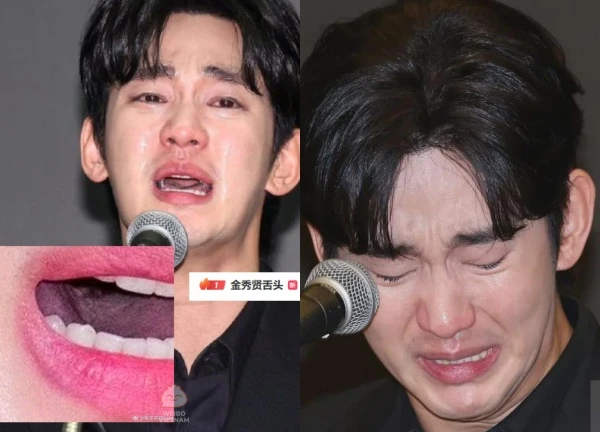 Kim Soo Hyun bị soi lưỡi lúc khóc, nghi mắc bệnh nhạy cảm "khó nói"