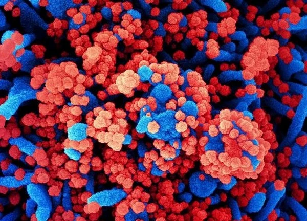Nga lên tiếng về loại virus chưa xác định gây ra tình trạng ho ra máu