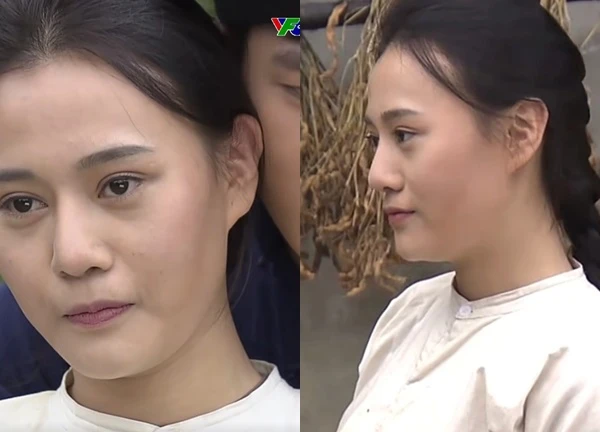 Đoạn clip trước khi thẩm mỹ của phú bà Việt viral trở lại, gương mặt lộ rõ khuyết điểm
