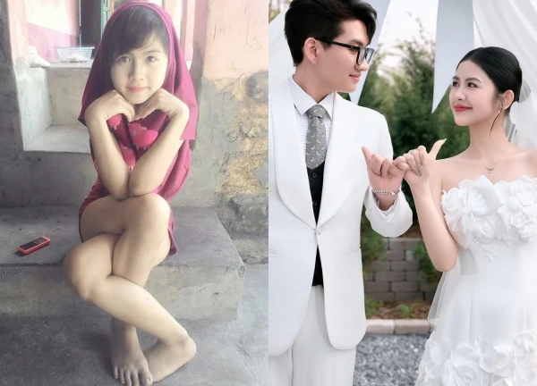 Ngố Thư: "Hot girl chân khoèo" gây sốt 1 thời, lột xác khác lạ, lấy hồng hài nhi