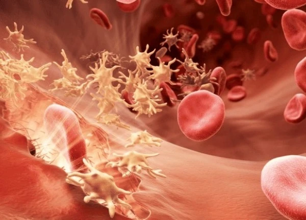 Sarcoma mạch máu: Ung thư hiếm gặp nhưng nguy hiểm