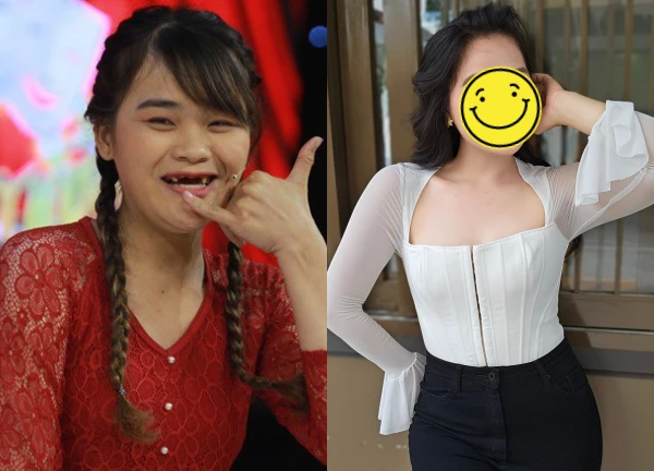 "Thánh sún" Ngân Thảo sau 6 năm Thách Thức Danh Hài, diện mạo khác lạ, CĐM sốc