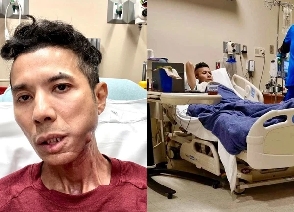Cuộc sống của Kasim Hoàng Vũ sau ca phẫu thuật bệnh hiểm nghèo