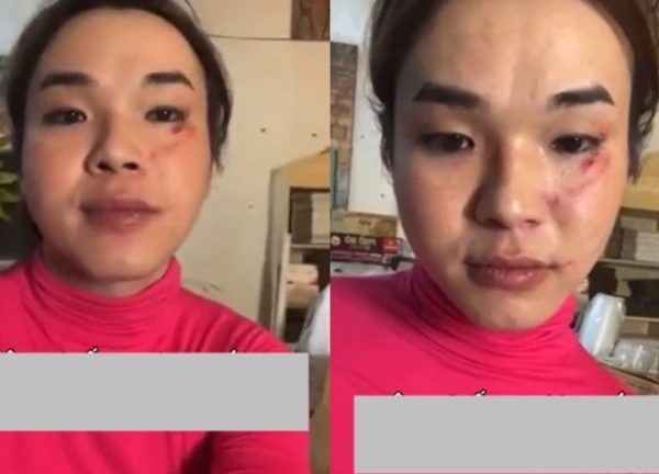 "Thánh gỏi đu đủ" Ty Thy tố bạn trai trộm hơn 7 cây vàng, hành hung: Người đàn ông lên tiếng
