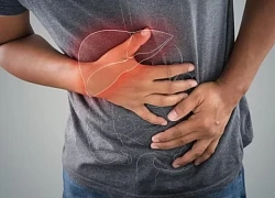 Bỏ qua 2 triệu chứng không đau, người đàn ông phát hiện ung thư khi đã muộn