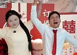 Cô gái bị bỏng 95% cơ thể tiết lộ điều trùng hợp đặc biệt với chồng sắp cưới
