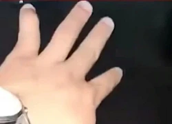 Chủ quán cơm gà hành hung khách ở Bình Định: Công an vào cuộc điều tra
