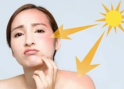 Da mụn, nám, sạm kéo dài - giải pháp phục hồi từ bác sĩ da liễu