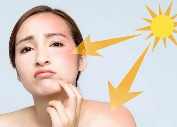 Da mụn, nám, sạm kéo dài - giải pháp phục hồi từ bác sĩ da liễu