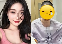 Người mẫu nổi tiếng bị bố ruột "hại", bỏng biến dạng mặt, CĐM nghi chiêu trò?