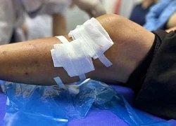Người phụ nữ bị chó nhà tấn công, nhiều vết thương khắp cơ thể