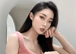 Sốc: Người mẫu 27 tuổi bỏng nặng, mặt biến dạng sau vụ nổ khí gas kinh hoàng