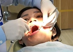 Hạn chế cao răng tại nhà bằng cách ăn uống cực đơn giản
