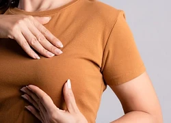 Các dấu hiệu ở núm vú phụ nữ cần lưu ý