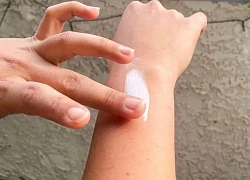 Cách xử trí khi bị dị ứng kem chống nắng