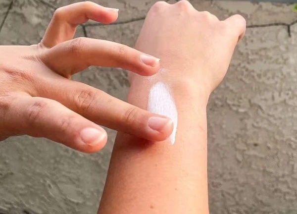Cách xử trí khi bị dị ứng kem chống nắng