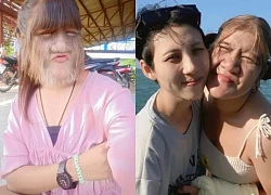 "Cô gái nhiều lông nhất" sau 15 năm nổi tiếng: 1 đời chồng, hạnh phúc bên bồ mới