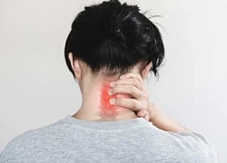 Đau cổ vai gáy có nguy hiểm, khi nào là bệnh lý phải nhập viện?