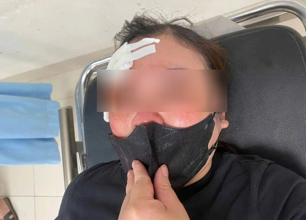 Nữ tài xế ở Hà Nội 'tố' bị người đi ô tô dùng dùi cui vụt vào đầu