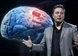 Tự chỉnh video, kể chuyện bằng... chip não Neuralink