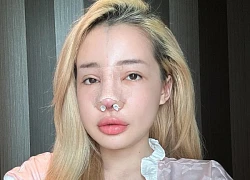 Ngân 98 "nghiện" phẫu thuật thẩm mỹ, chuẩn bị "đập mặt xây lại" lần thứ 12