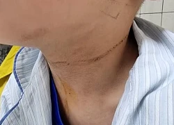Những vật dụng trong nhà có thể trở thành 'kẻ sát nhân' đối với trẻ