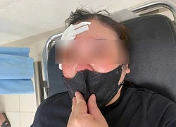 Triệu tập người trên ô tô bán tải bị tố vụt dùi cui vào đầu nữ tài xế
