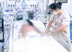 Bé gái 10 tuổi sốc sốt xuất huyết nặng, nguy kịch vì béo phì
