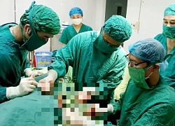 Cành cây dài 20cm nằm trong lồng ngực bệnh nhân hơn 2 năm