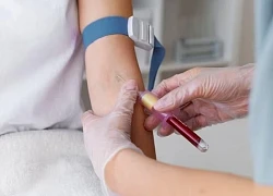 Chỉ số mỡ máu cao, điều gì đang chờ phía sau?