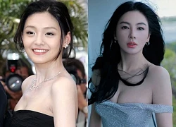 Dàn mỹ nhân giảm cân kinh hãi: Từ Hy Viên suy kiệt vì quá cực đoan, có người bị báo động đỏ