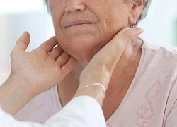 Suy giáp có nguy hiểm không?