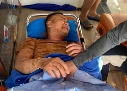 Cha lao xuống giếng cứu con ở Gia Lai: 'Tôi đã nghĩ đến điều xấu nhất'