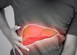 5 dấu hiệu cảnh báo sớm nhất gan bị tổn thương, bạn chớ bỏ qua