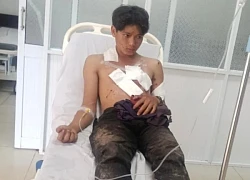 Nổ mìn tự chế khi đi đánh cá, 2 thanh niên bị thương nặng