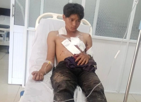 Nổ mìn tự chế khi đi đánh cá, 2 thanh niên bị thương nặng